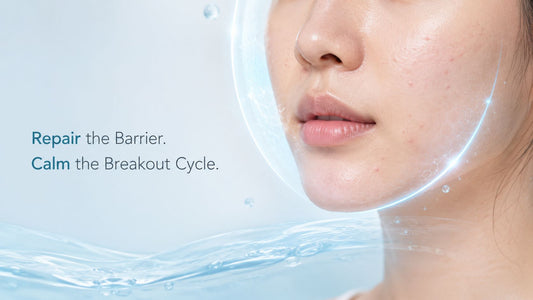 Damaged skin barrier and acne-prone skin with PURAMORIA hydrating cream