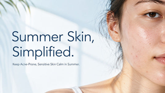 Summer skincare routine for acne-prone sensitive skin